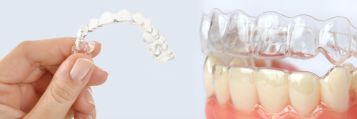 Gaithersburg  Alternative to Braces for Teens