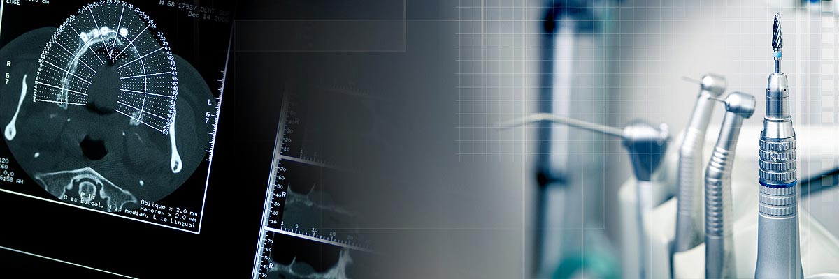 Gaithersburg  Will I Need a Bone Graft for Dental Implants?