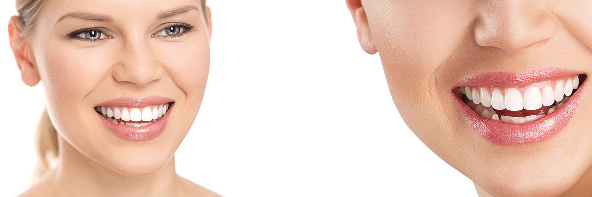 Gaithersburg  Cosmetic Dental Care