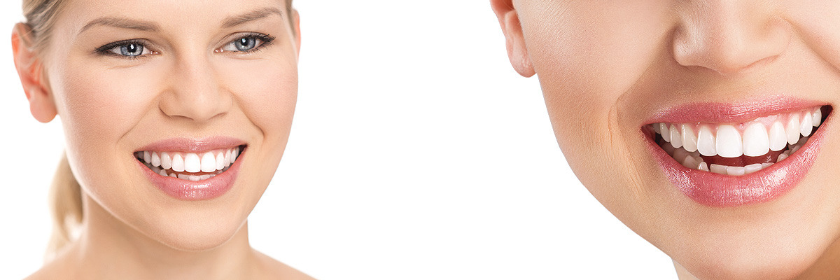 Gaithersburg  Cosmetic Dental Services