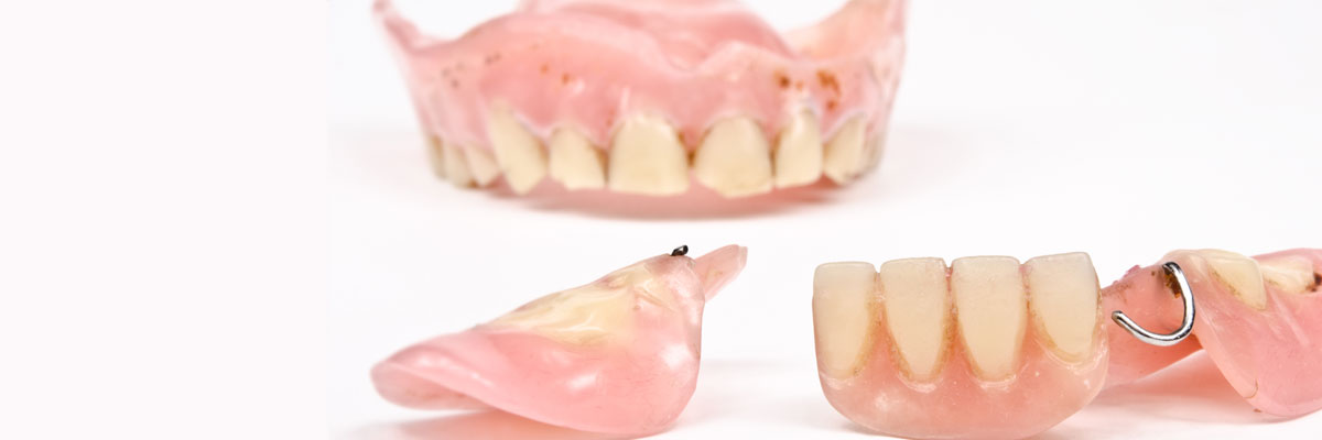 Gaithersburg  What Do I Do If I Damage My Dentures?