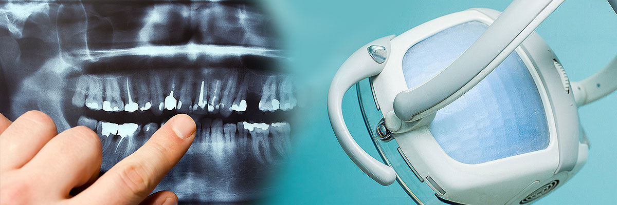 Gaithersburg  Dental Cleaning