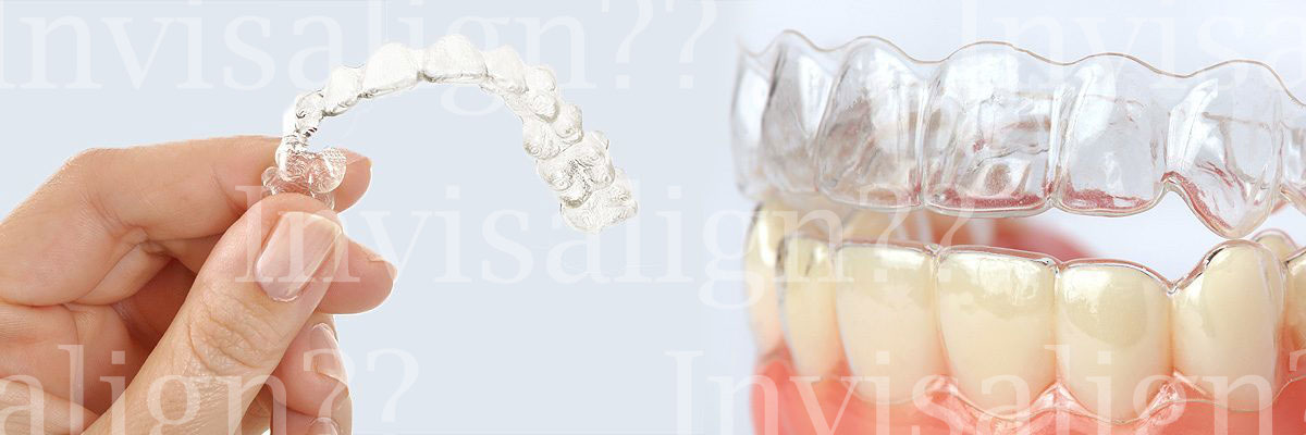 Gaithersburg  Does Invisalign® Really Work?