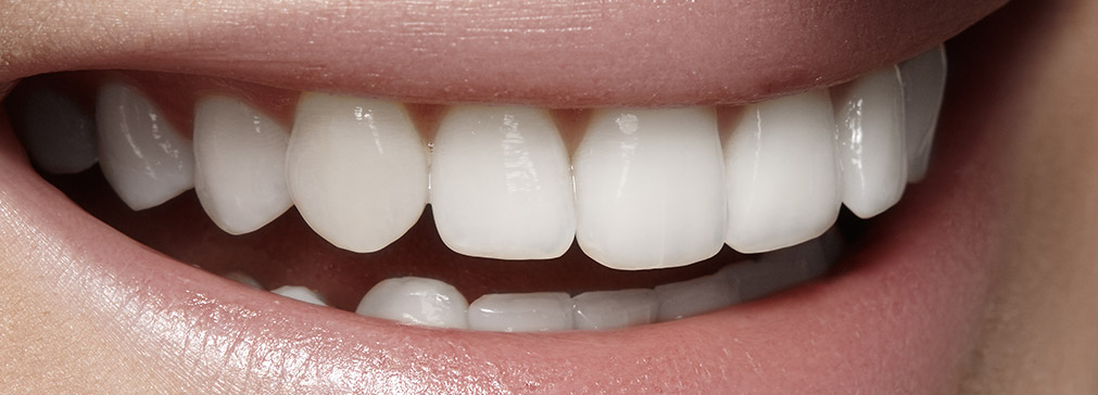 Gaithersburg  Full Mouth Reconstruction