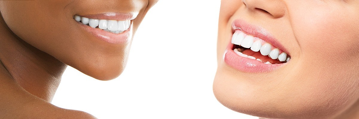 Gaithersburg  Improve Your Smile for Senior Pictures