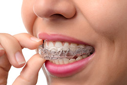 Invisalign Dentist