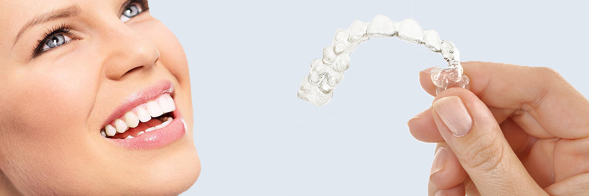 Gaithersburg  7 Things Parents Need to Know About Invisalign Teen