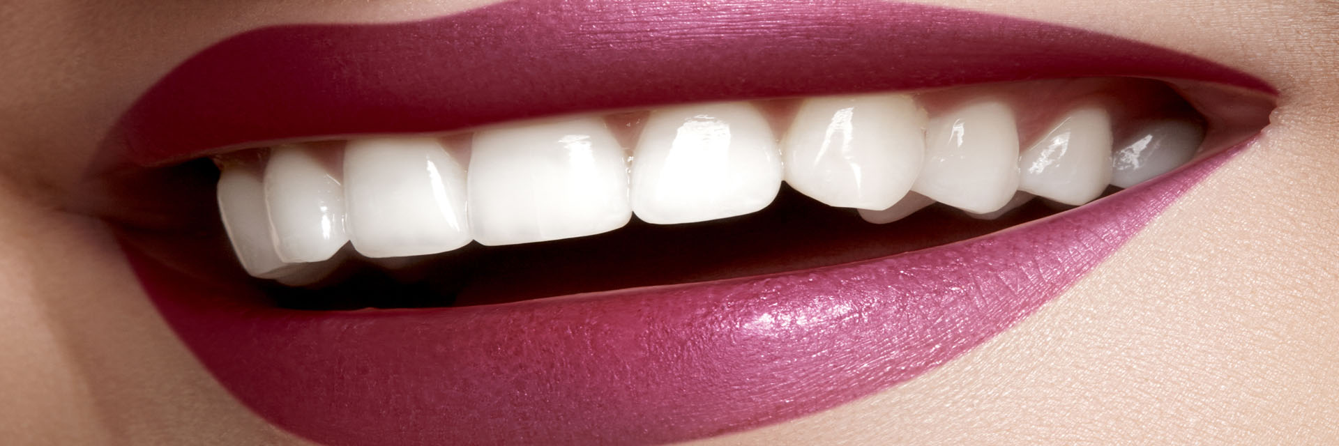 Gaithersburg  Smile Makeover
