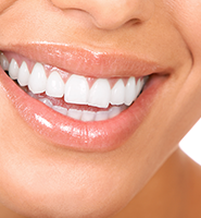 Teeth Whitening Services Gaithersburg , MD