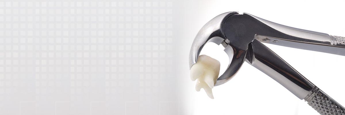 Gaithersburg  Tooth Extraction